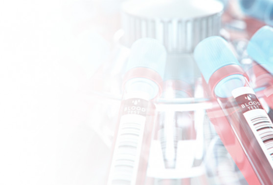 How to Turn Complex Analytical Workflows into LC/MS Biomarker Assays